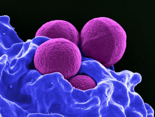 أدرجت منظمة الصحة العالمية بكتيريا المكورة العنقودية الذهبية staphylococcus aureus&nbsp; كأحد مسببات الأمراض ذات الأولوية الكبيرة.&nbsp;